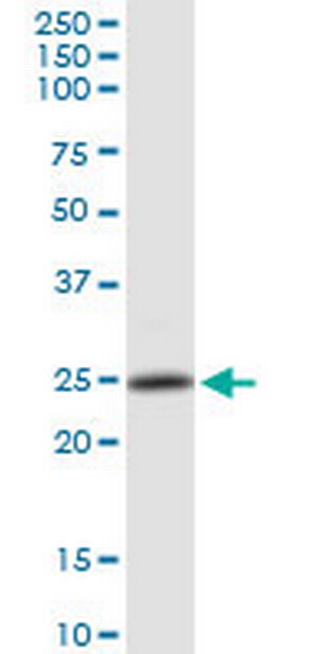 PSMB4 Antibody in Western Blot (WB)