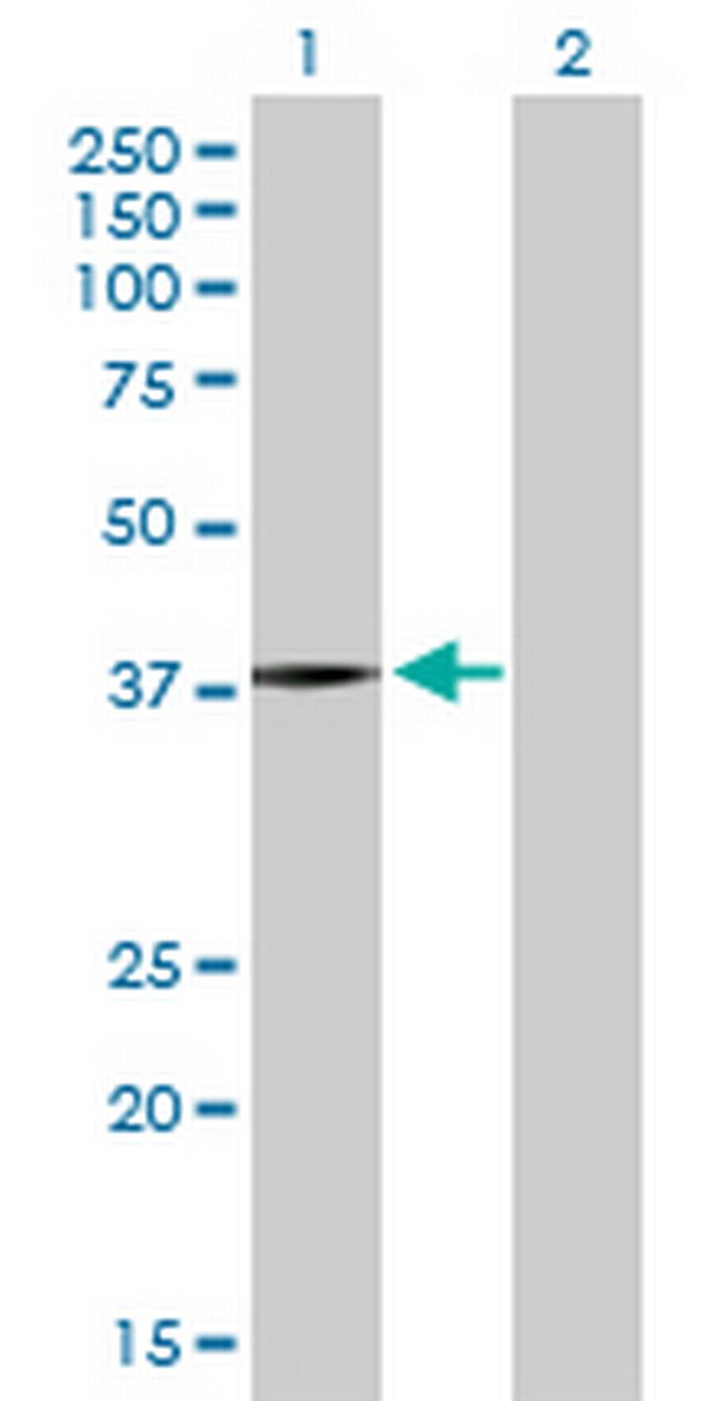 PSMB5 Antibody in Western Blot (WB)