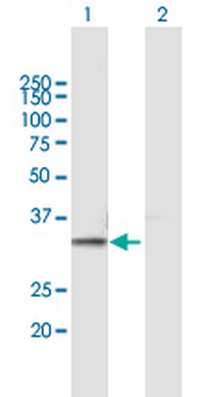 PSMB7 Antibody in Western Blot (WB)