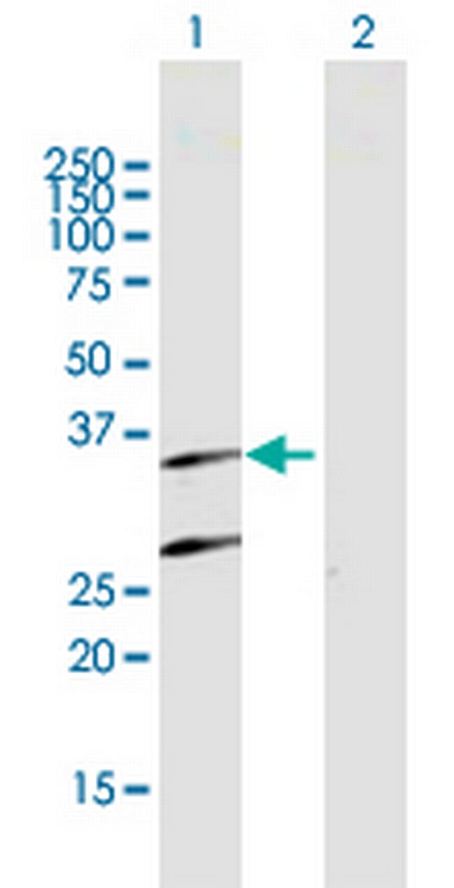 PSMB7 Antibody in Western Blot (WB)