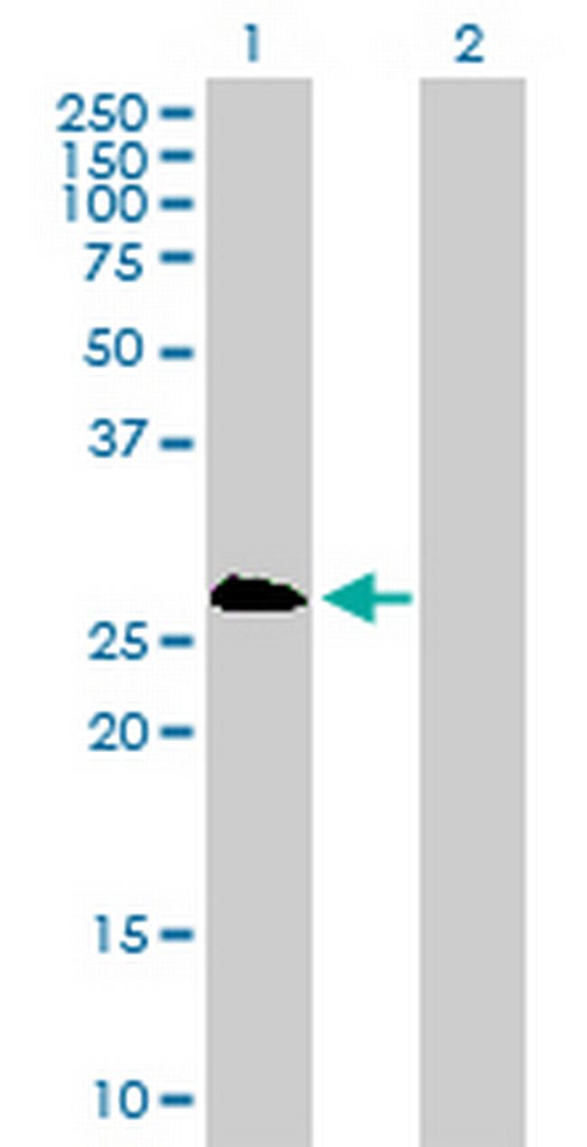 PSMB8 Antibody in Western Blot (WB)