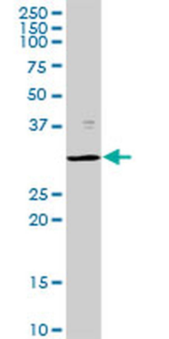 PSMB8 Antibody in Western Blot (WB)