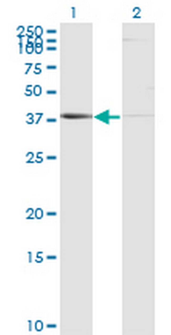 PSMB8 Antibody in Western Blot (WB)