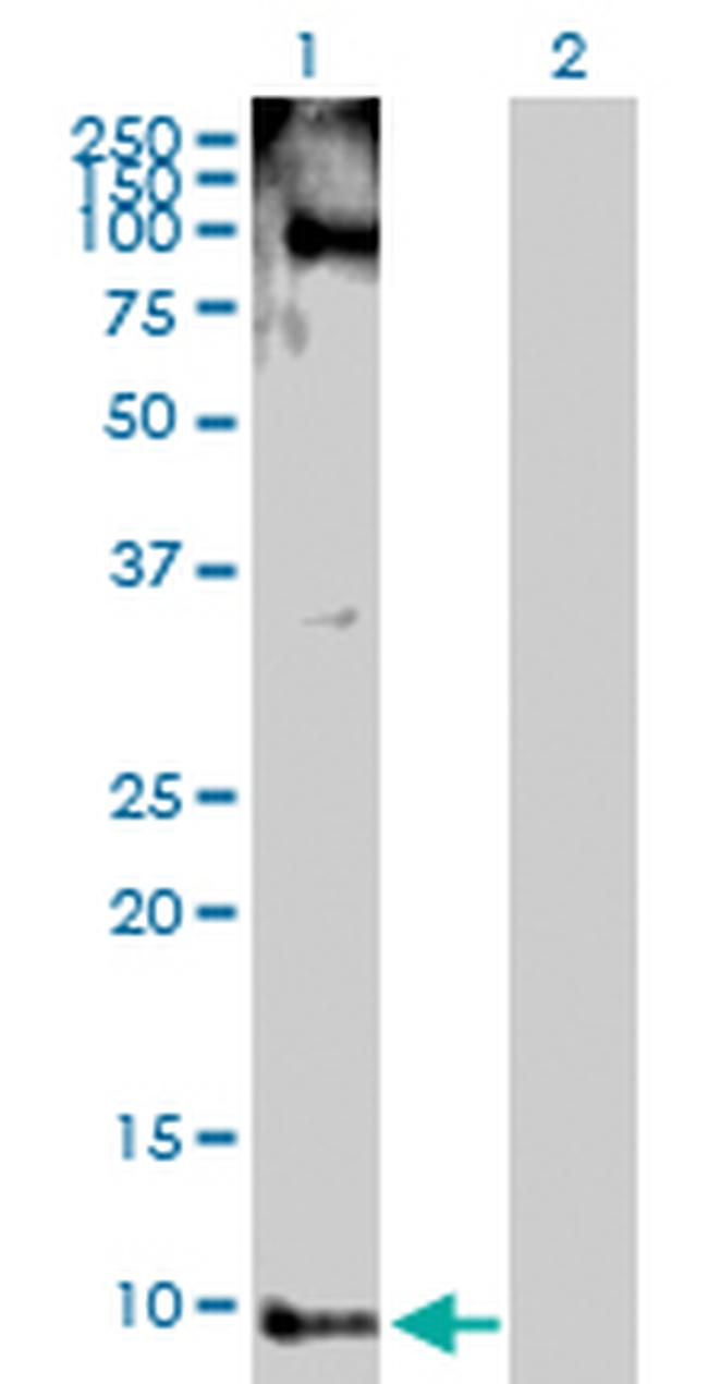 PYY Antibody in Western Blot (WB)