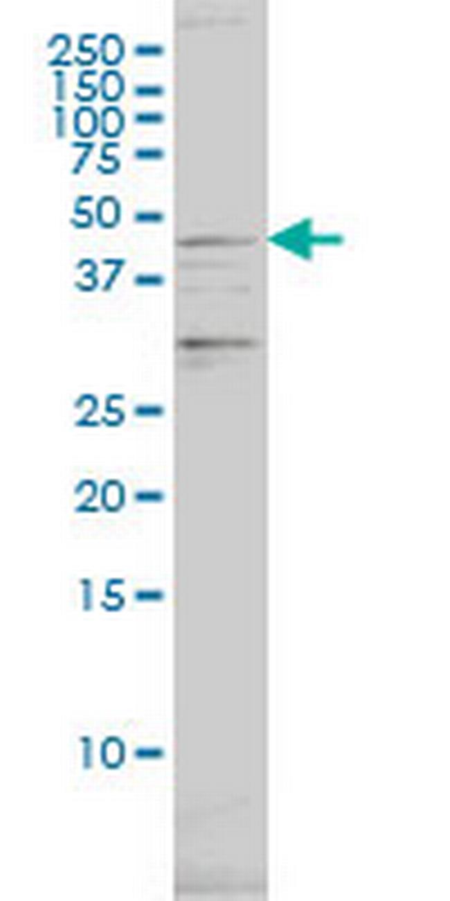 PSMC2 Antibody in Western Blot (WB)