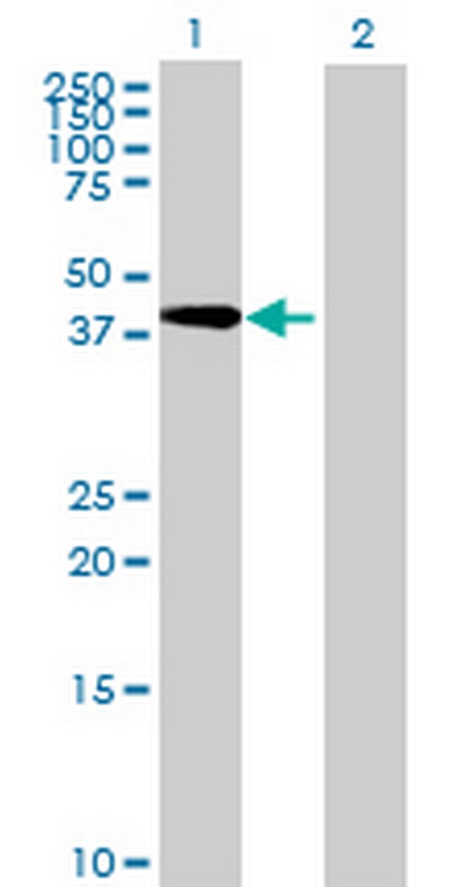 PSMC4 Antibody in Western Blot (WB)