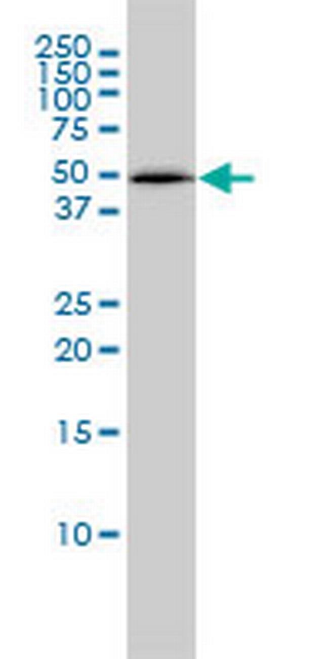 PSMC4 Antibody in Western Blot (WB)