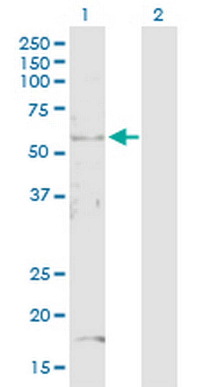 PSMD4 Antibody in Western Blot (WB)