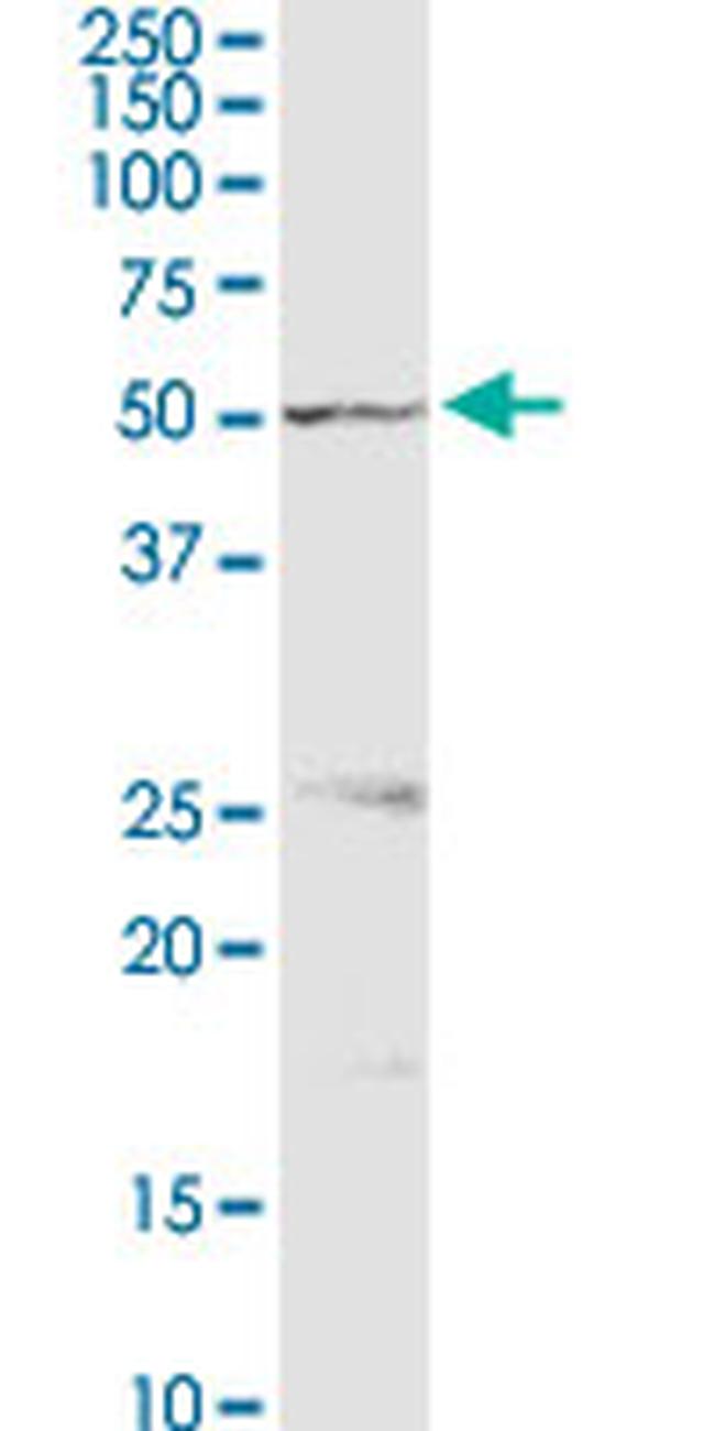 PSMD5 Antibody in Western Blot (WB)