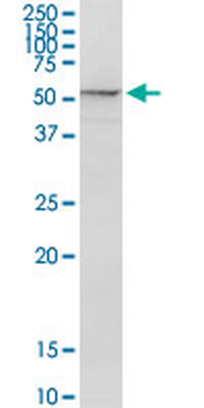 PSMD5 Antibody in Western Blot (WB)