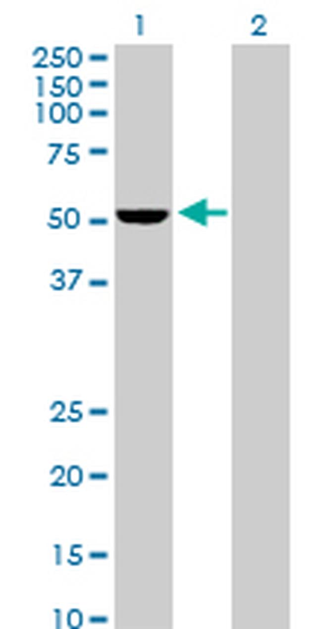 PSMD5 Antibody in Western Blot (WB)