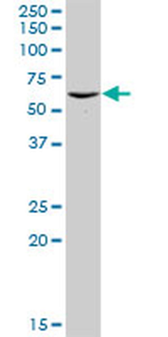 PSMD5 Antibody in Western Blot (WB)