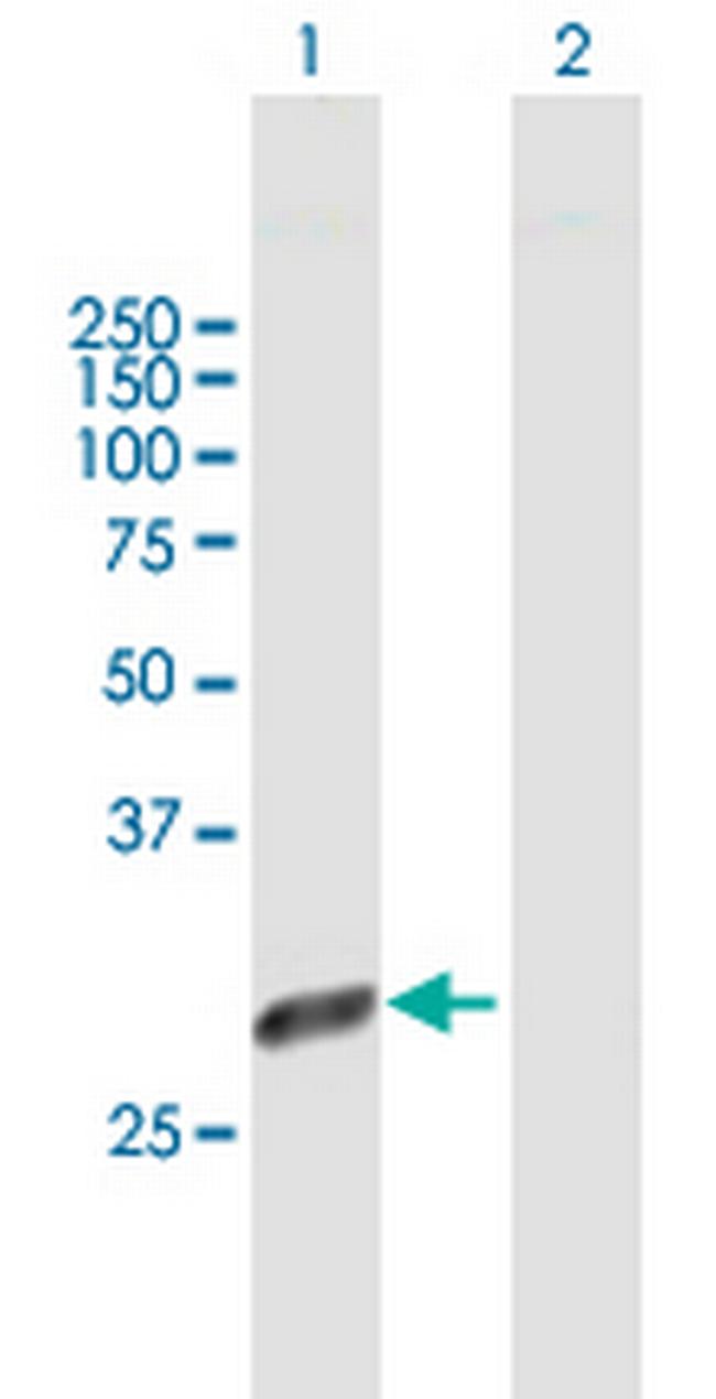 PSMD9 Antibody in Western Blot (WB)