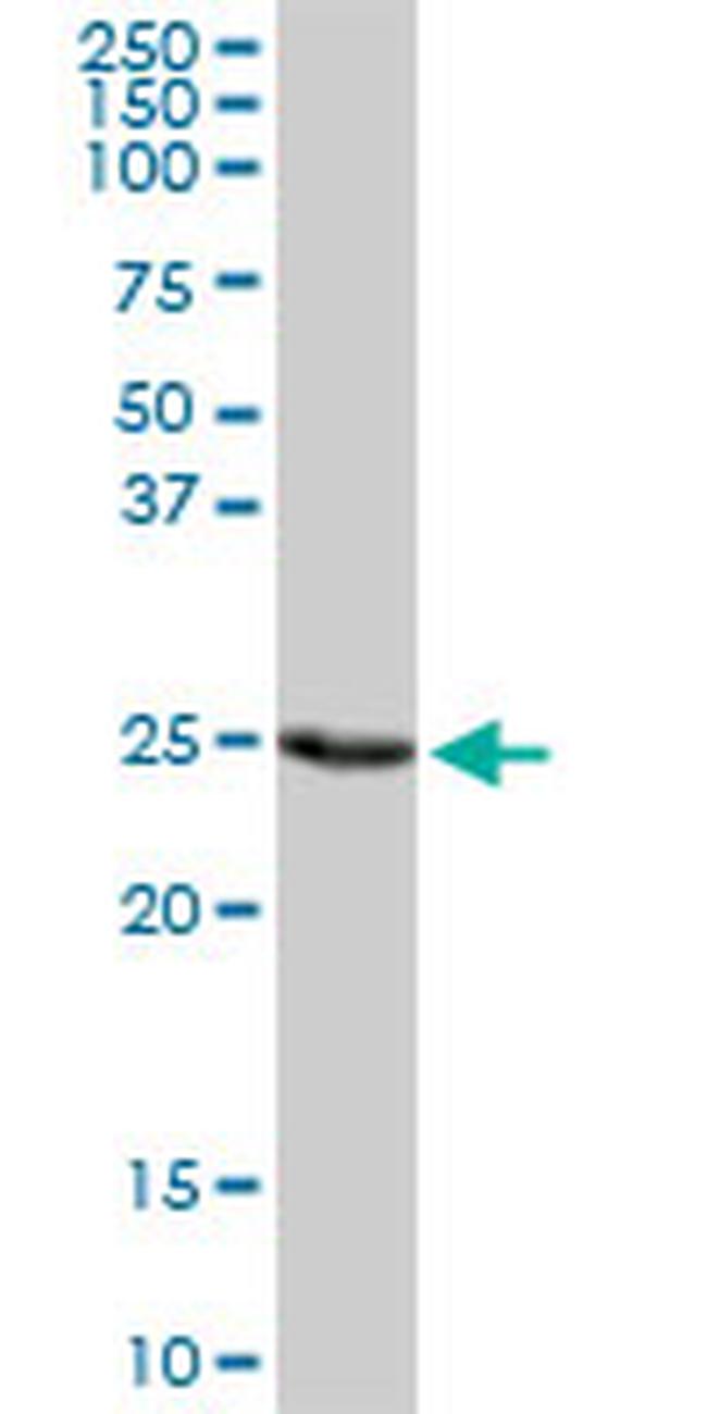 PSMD9 Antibody in Western Blot (WB)