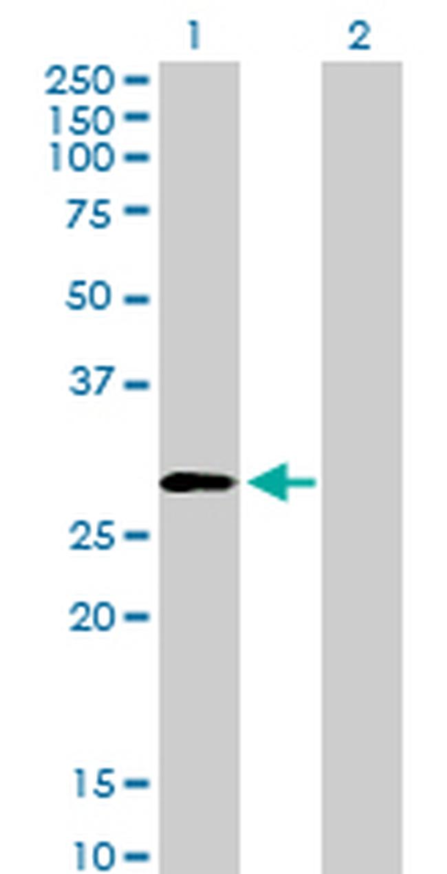 PSMD9 Antibody in Western Blot (WB)