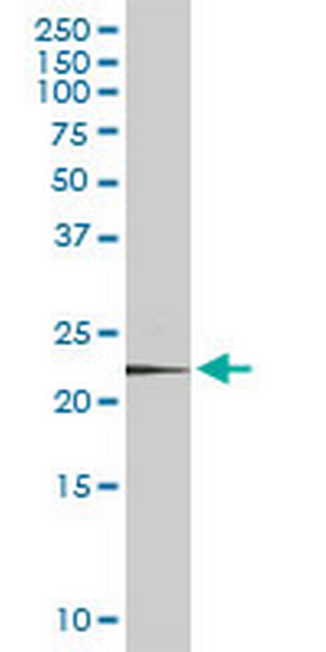 PSMD10 Antibody in Western Blot (WB)