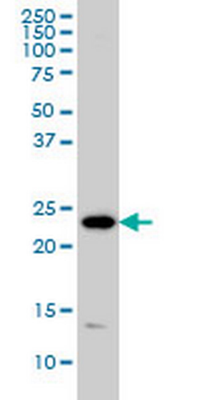 PSMD10 Antibody in Western Blot (WB)