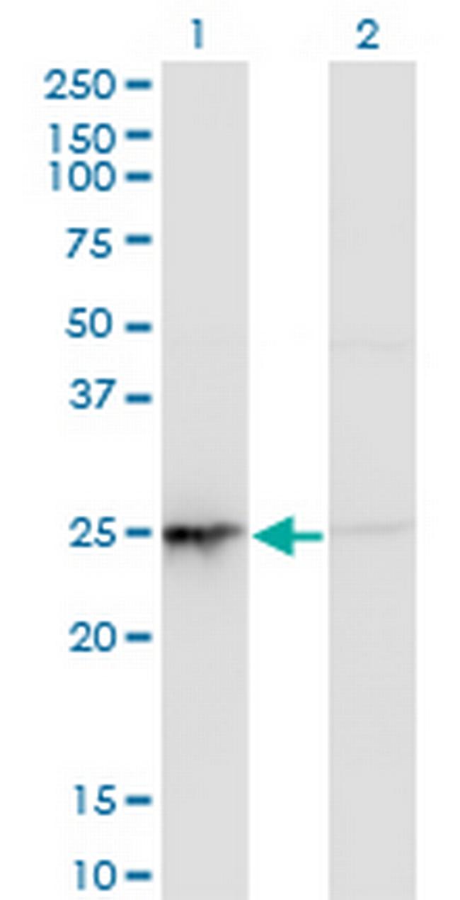 PSMD10 Antibody in Western Blot (WB)