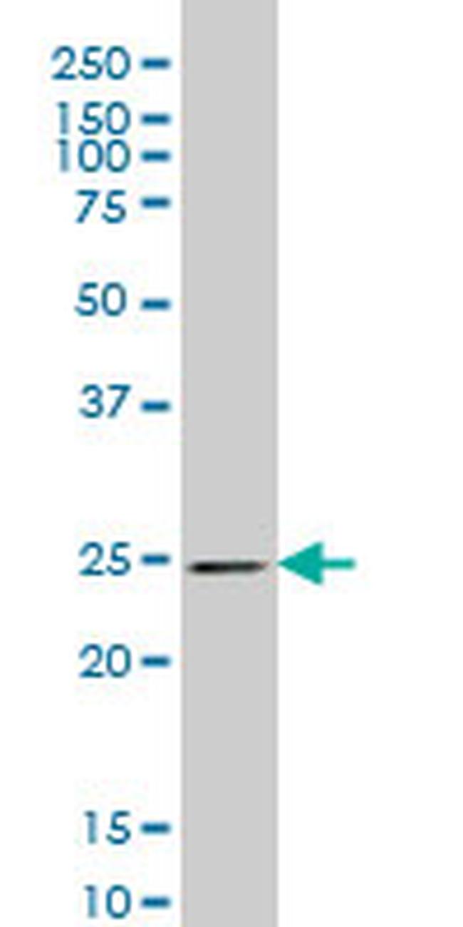 PSPH Antibody in Western Blot (WB)