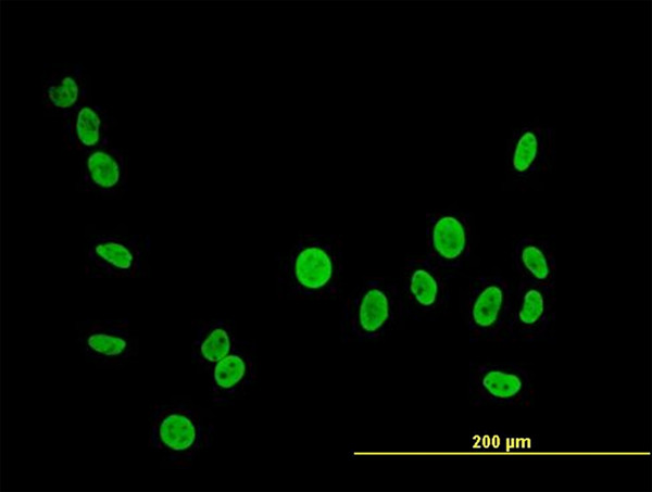 PTBP1 Antibody in Immunocytochemistry (ICC/IF)