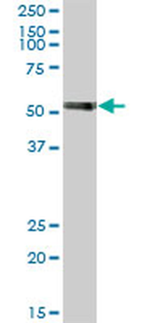 PTBP1 Antibody in Western Blot (WB)