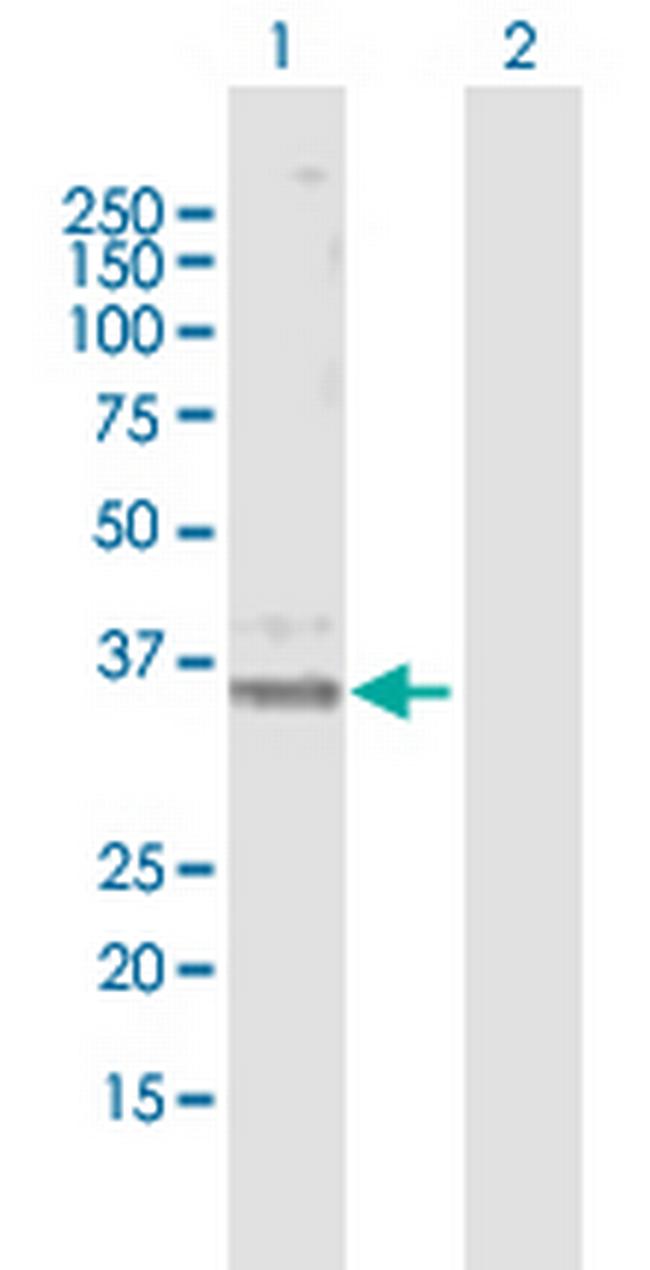 PTGER3 Antibody in Western Blot (WB)