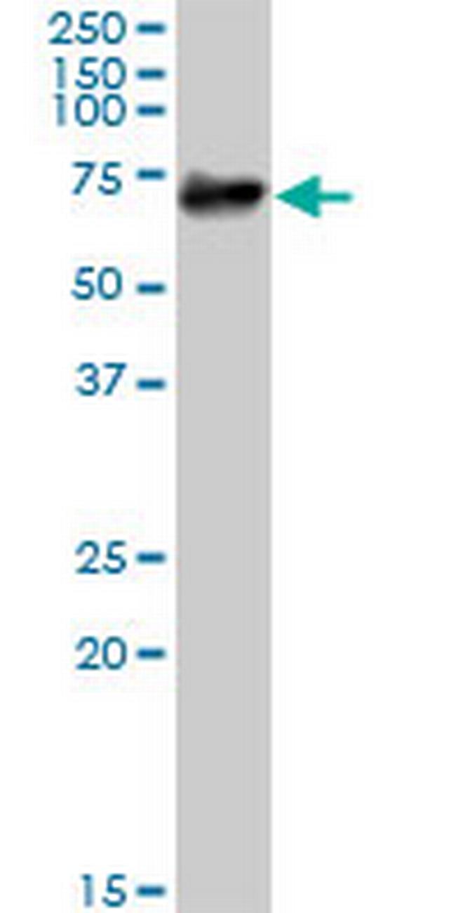 PTGS1 Antibody in Western Blot (WB)