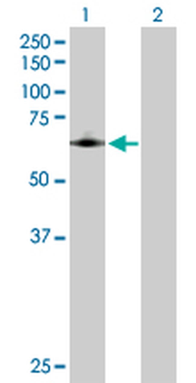 PTGS1 Antibody in Western Blot (WB)