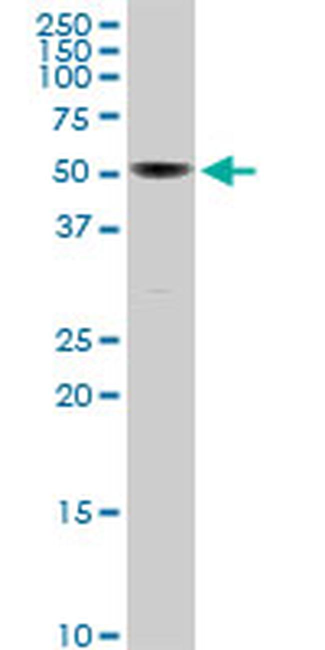 PTGS1 Antibody in Western Blot (WB)