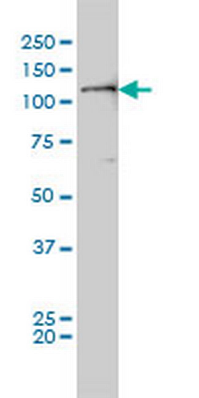 PTK2 Antibody in Western Blot (WB)