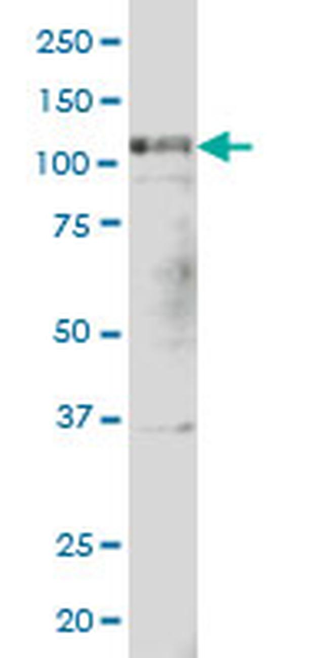 PTK2 Antibody in Western Blot (WB)