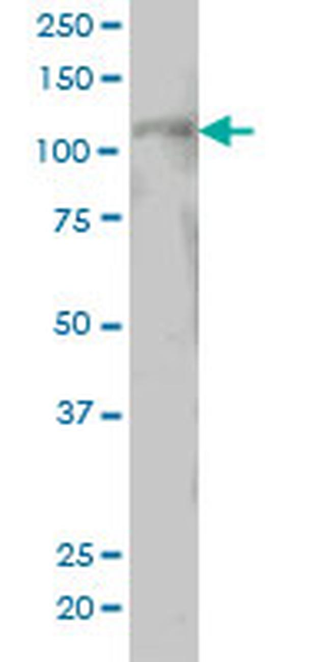 PTK2 Antibody in Western Blot (WB)