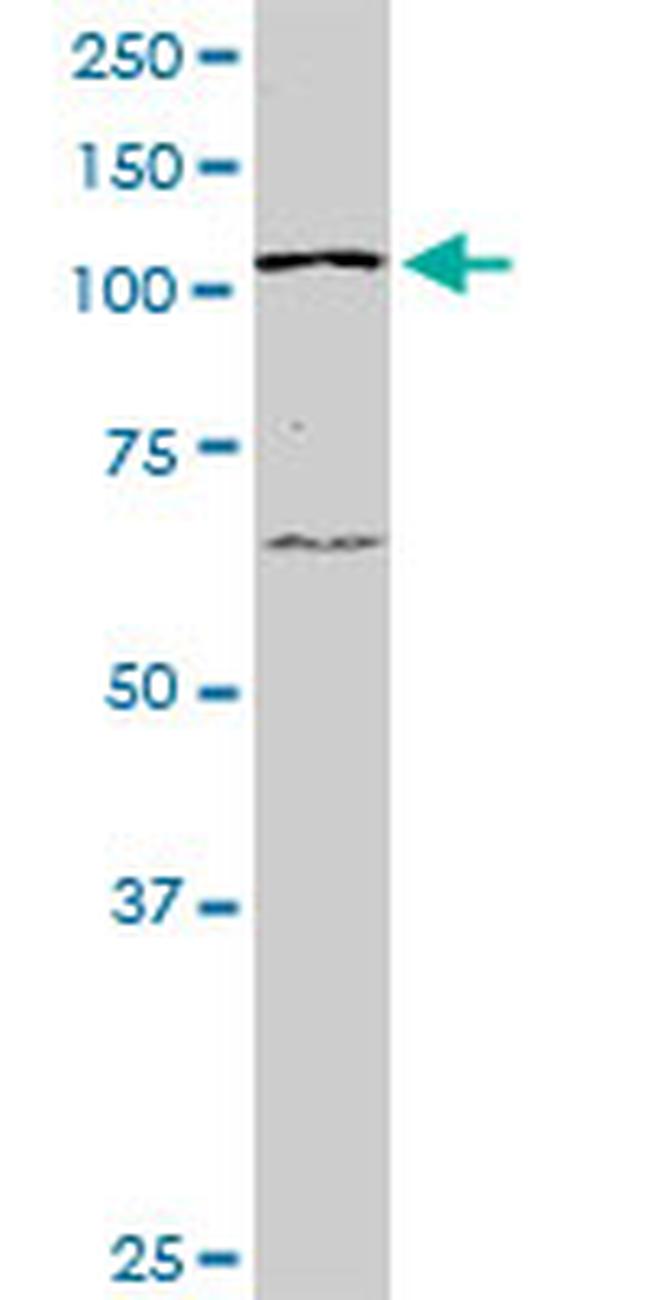 PTK2 Antibody in Western Blot (WB)