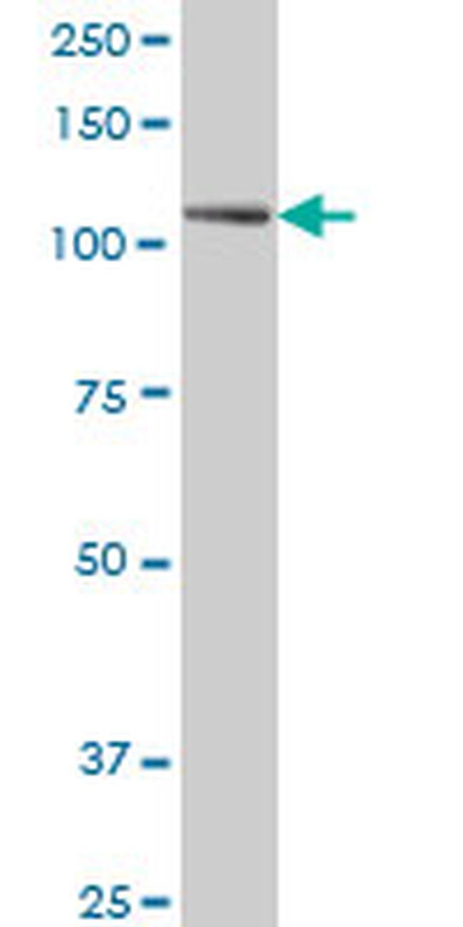 PTK7 Antibody in Western Blot (WB)