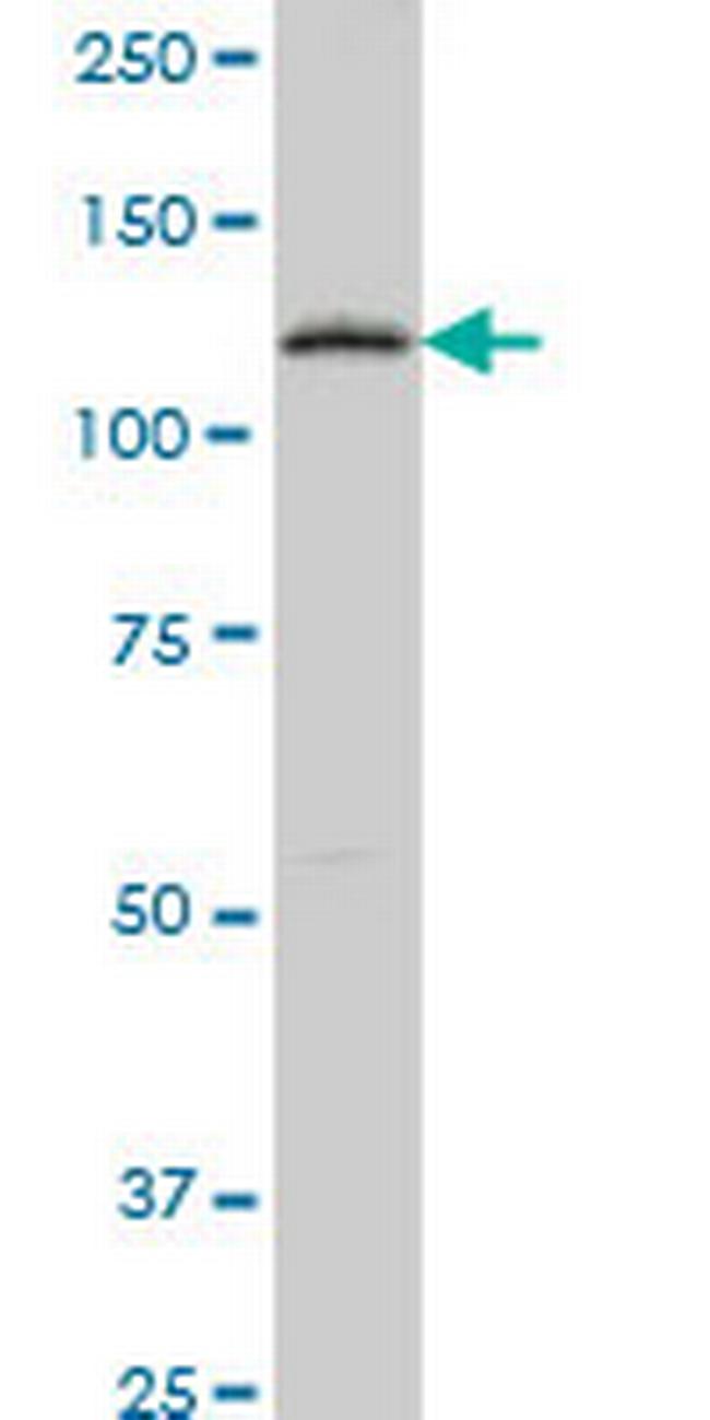 PTK7 Antibody in Western Blot (WB)