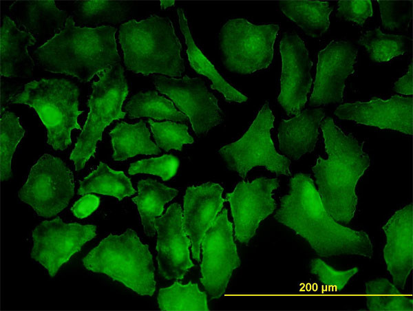 PTK7 Antibody in Immunocytochemistry (ICC/IF)