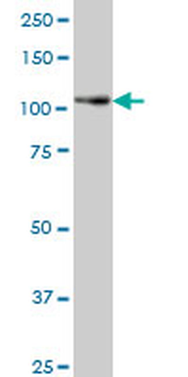 PTK7 Antibody in Western Blot (WB)