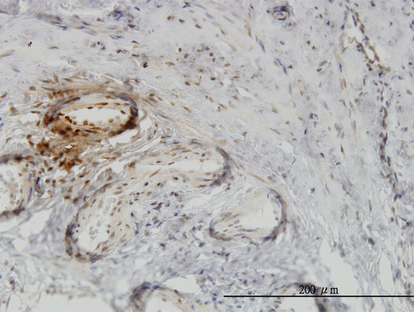 PTK9 Antibody in Immunohistochemistry (Paraffin) (IHC (P))