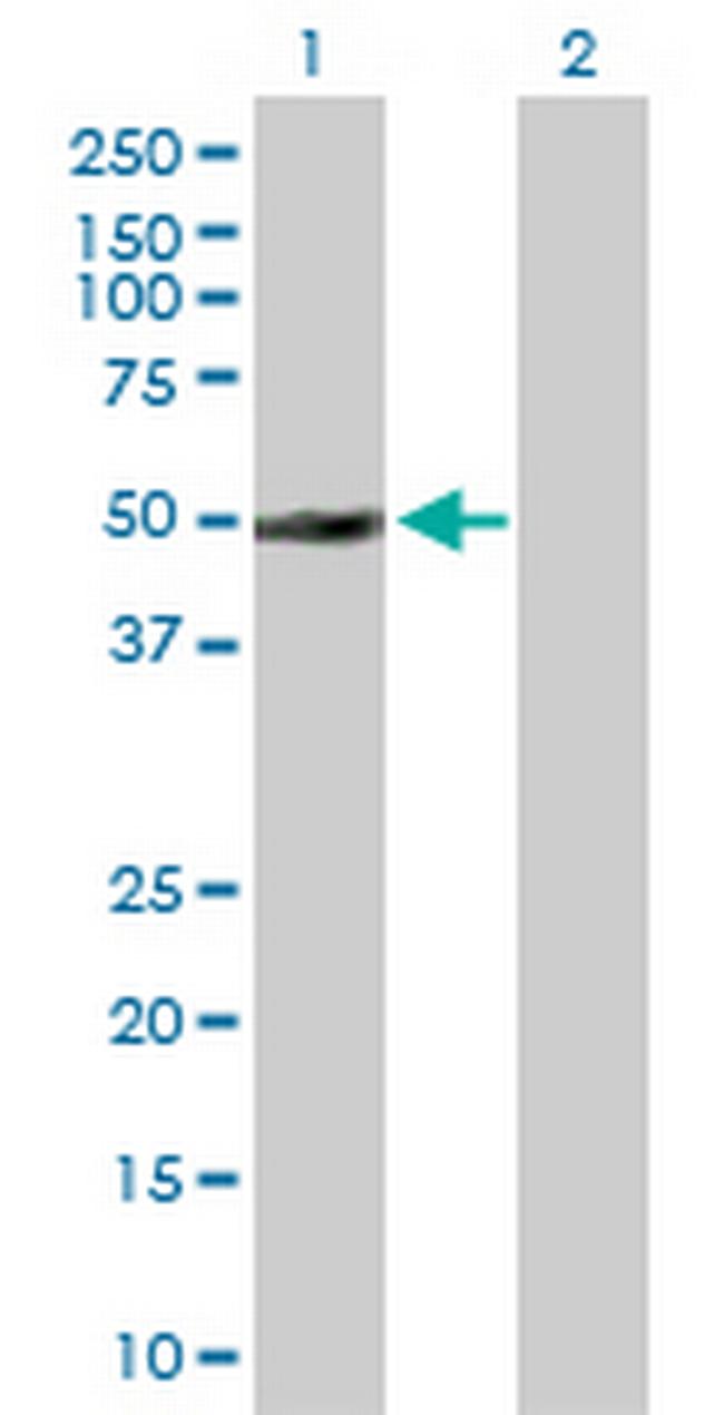 PTPN2 Antibody in Western Blot (WB)