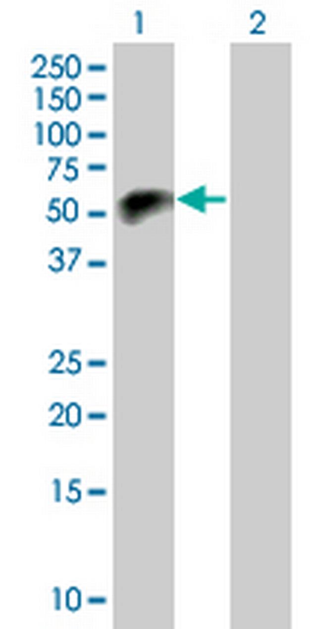 PTPN7 Antibody in Western Blot (WB)