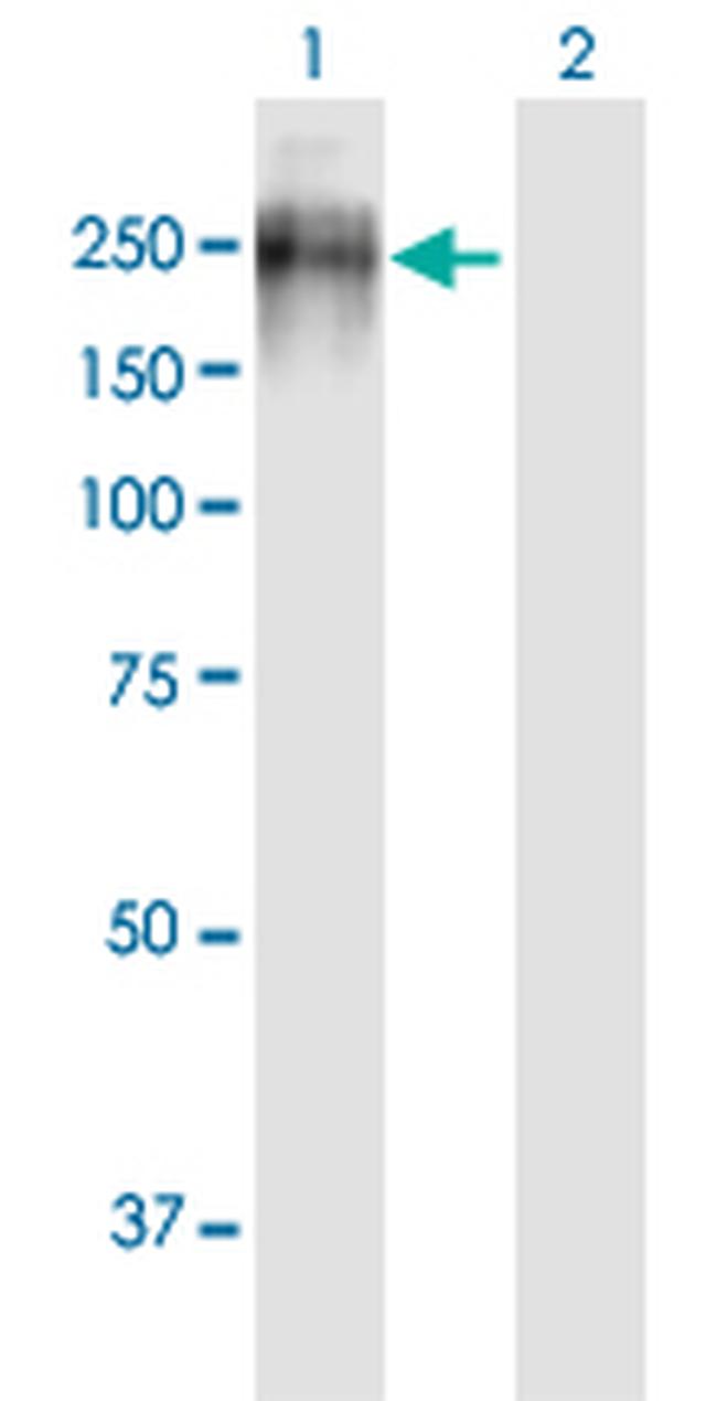 PTPRJ Antibody in Western Blot (WB)