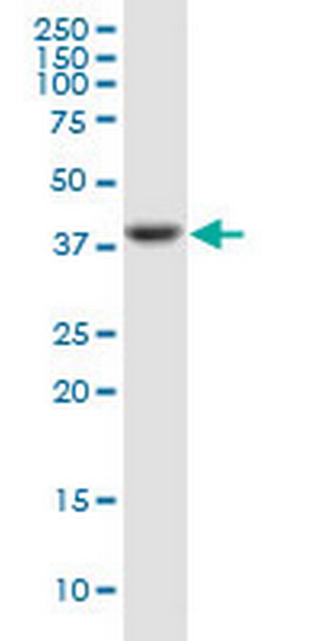 PTX3 Antibody in Western Blot (WB)