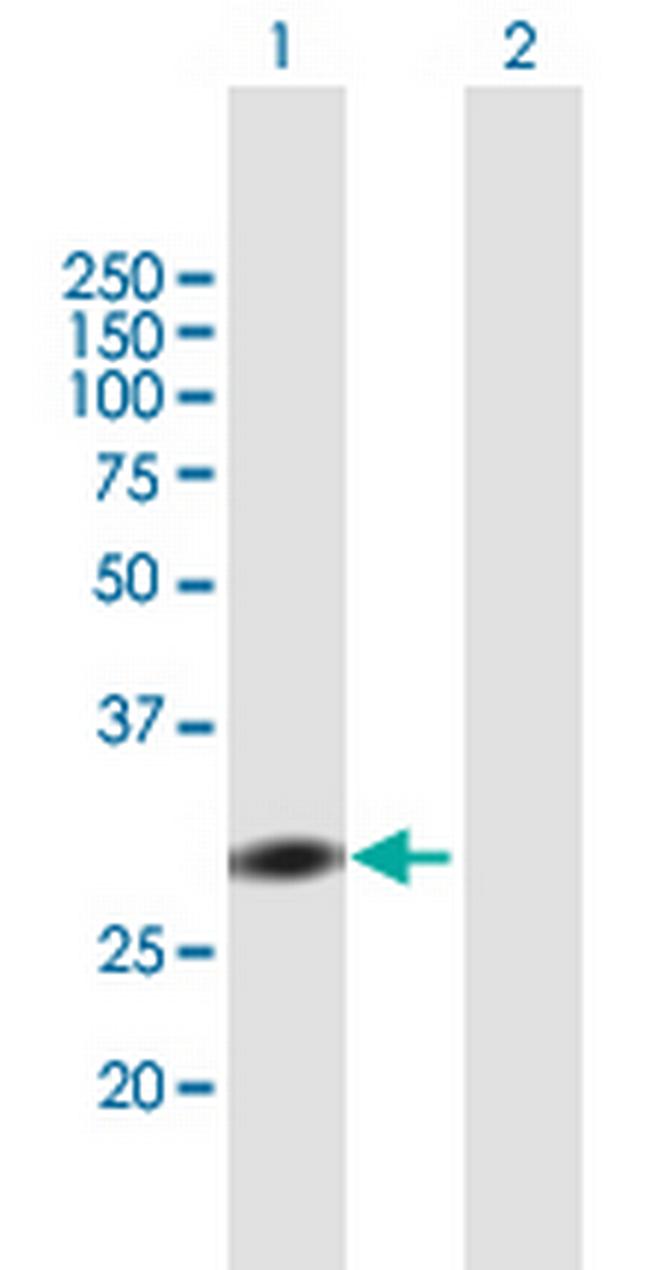 RAD1 Antibody in Western Blot (WB)