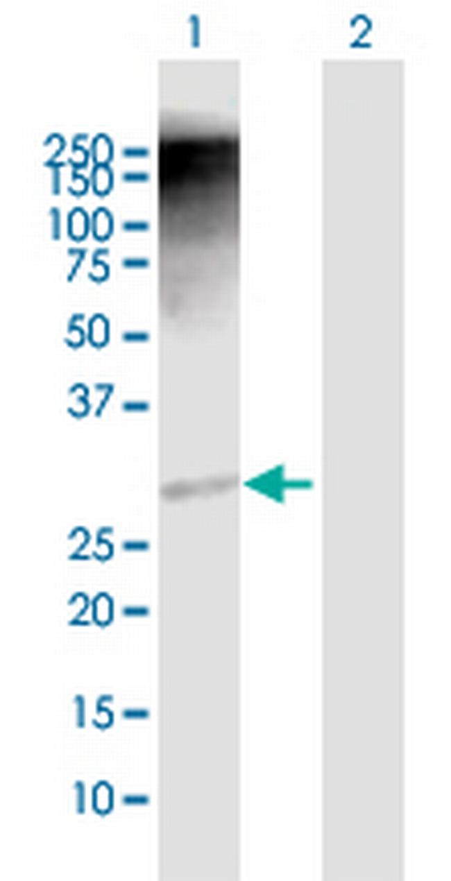 RAD1 Antibody in Western Blot (WB)