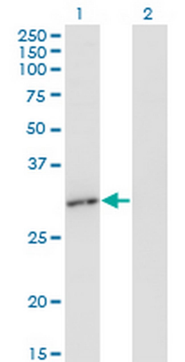 RAD1 Antibody in Western Blot (WB)