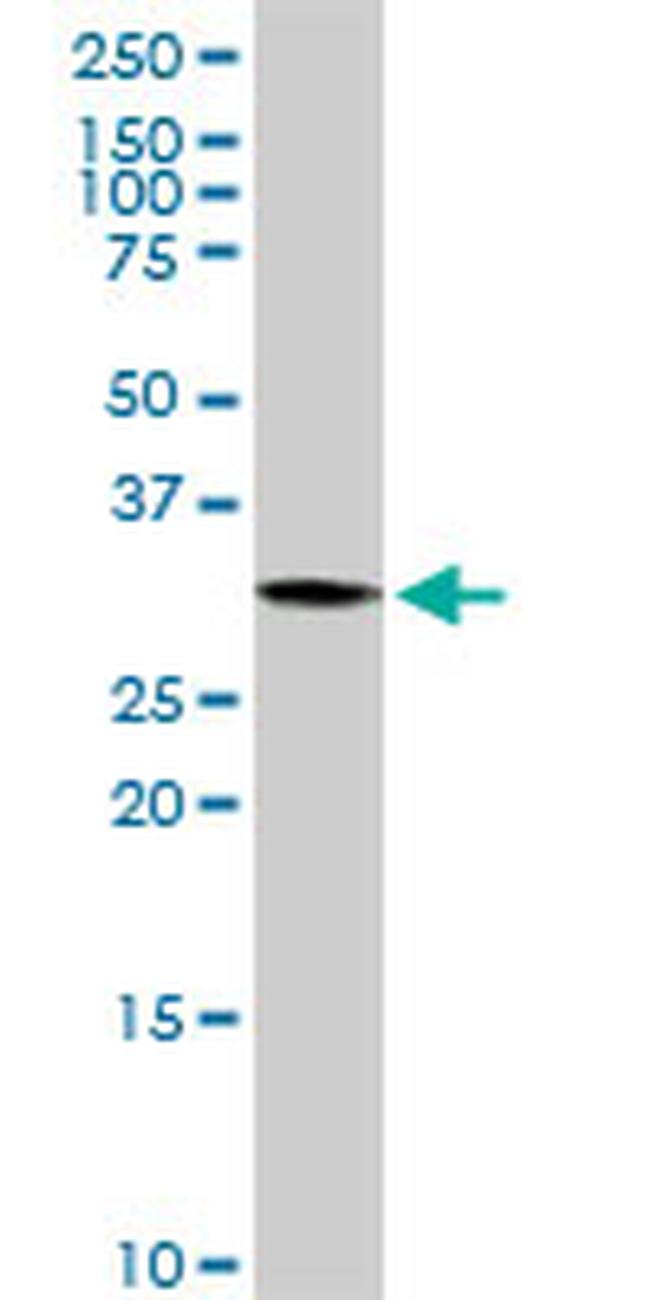 PYCR1 Antibody in Western Blot (WB)