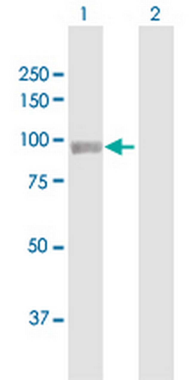 PYGL Antibody in Western Blot (WB)