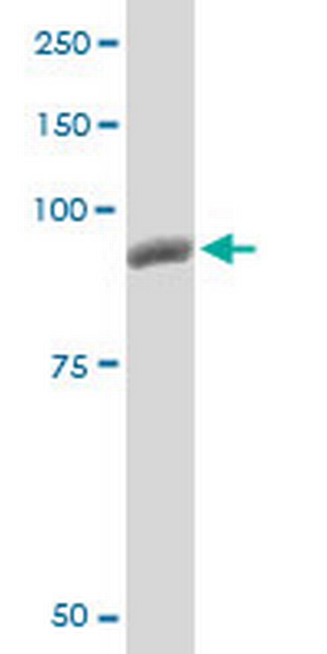 PYGM Antibody in Western Blot (WB)