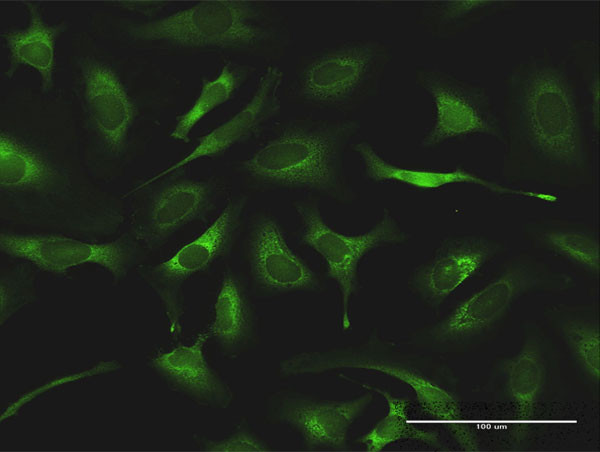 QARS Antibody in Immunocytochemistry (ICC/IF)