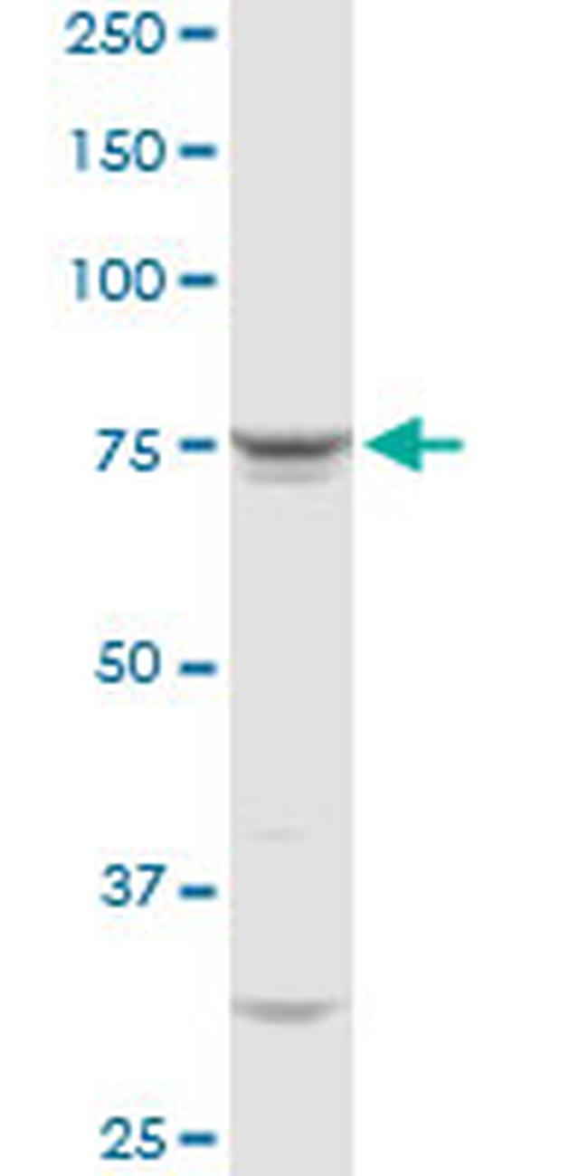 QARS Antibody in Western Blot (WB)